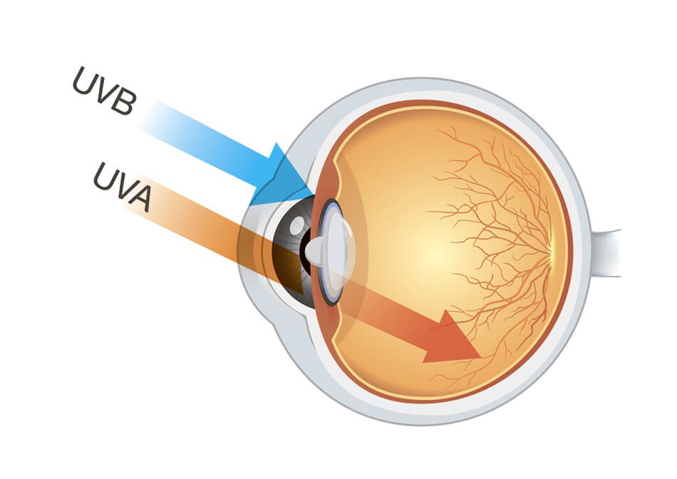 Consider Contact Lenses with UV Protection as an Added Defense Against the Sun
