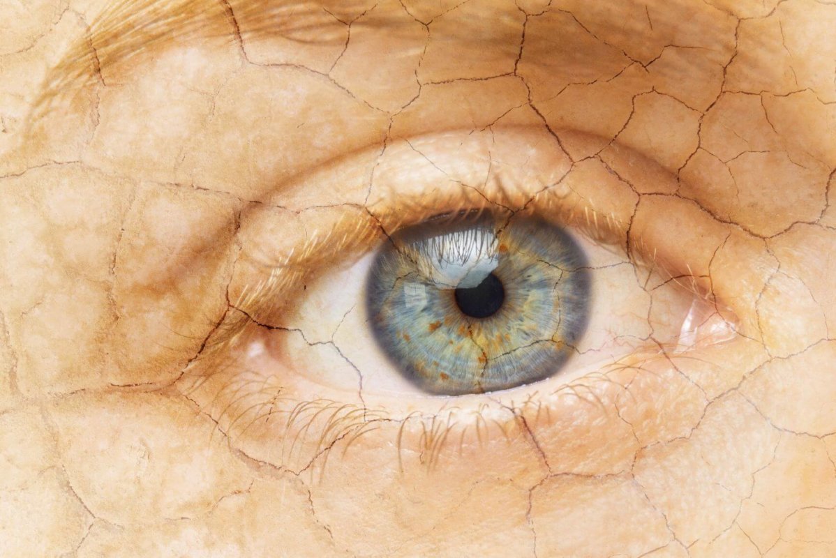 How to Alleviate Dry Eyes:  Choosing the Right Contact Lenses